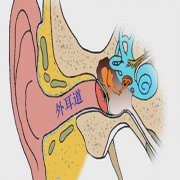 引发外耳道炎的原因有哪些？