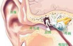 重庆专业耳科医院_鼓膜穿孔会导致耳聋吗