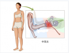 中耳炎症状有哪些表现,中耳炎治疗佳方法