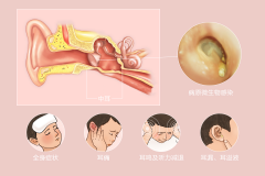 重庆中耳炎医院_重庆治疗中耳炎哪家医院好